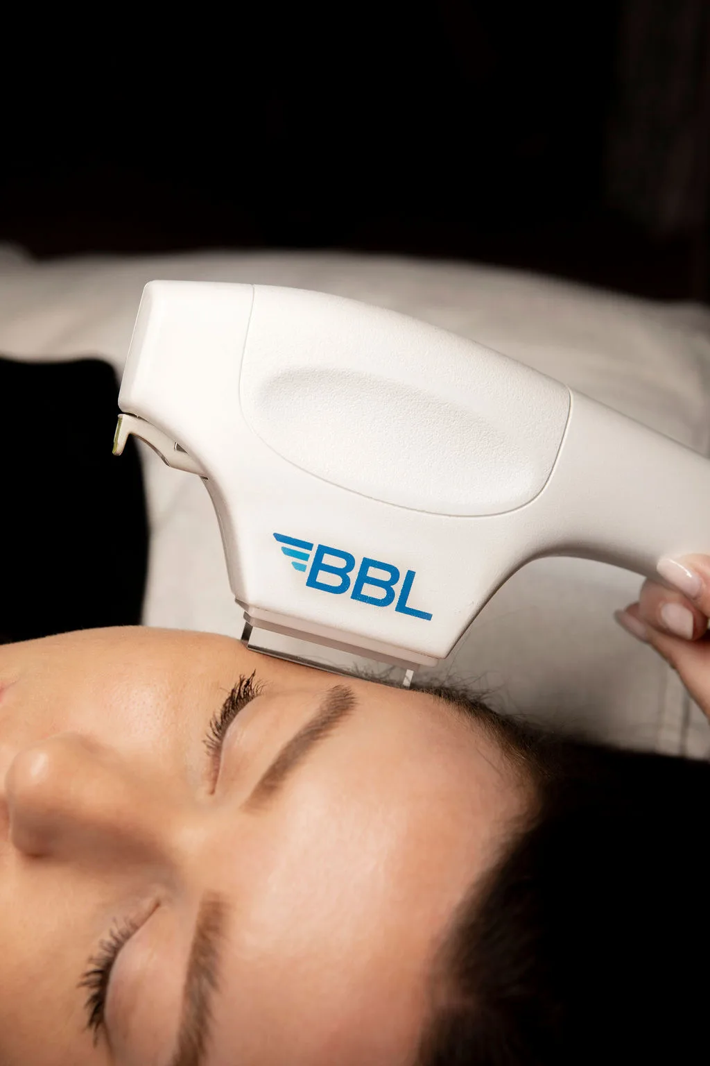 BBL Photo Rejuvenation in Gilbert, AZ