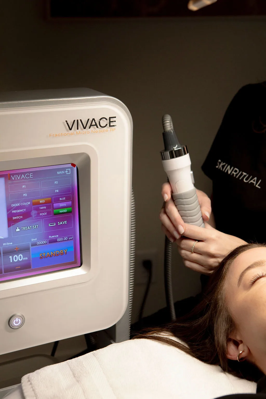 Vivace RF Microneedling in Gilbert, AZ