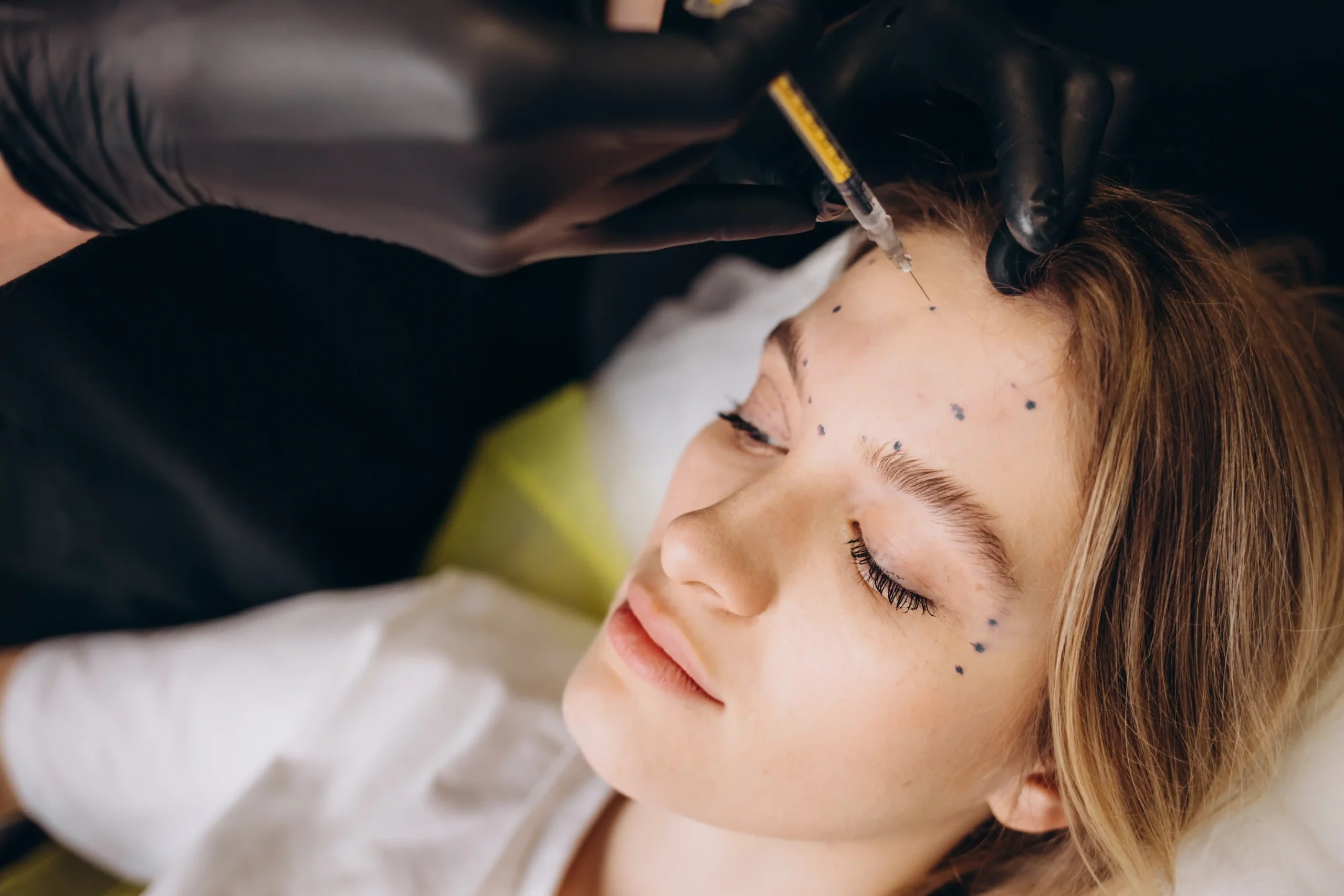 Can Neuromodulators Help Platysmal Bands How They Work as a Neck Treatment