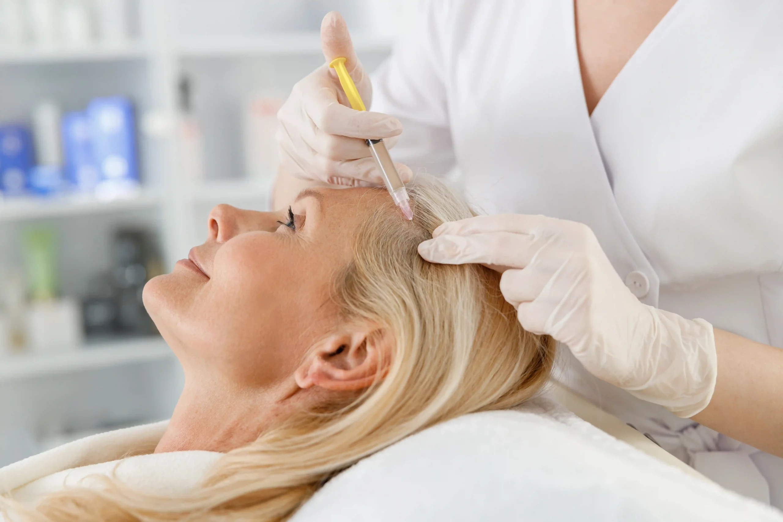 Woman receiving PRP hair restoration injection in scalp at Skin Ritual, Gilbert, AZ