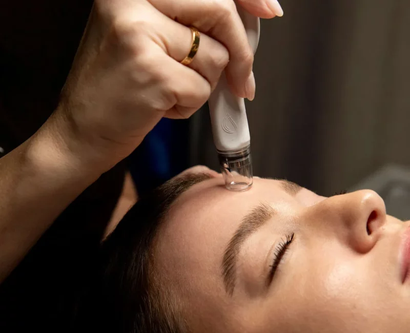 DiamondGlow Treatments in Gilbert, AZ