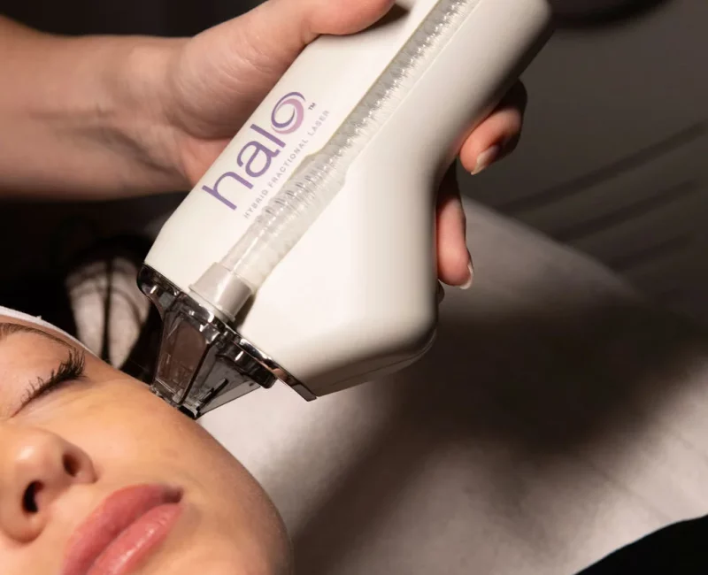 Halo Hybrid Laser in Gilbert, AZ