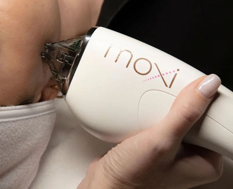 MOXIsup® supLaser In Gilbert, AZ